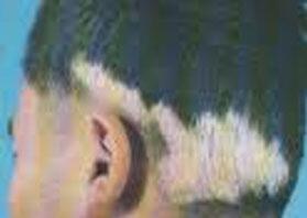ѧʳƻڰװ߻ָ