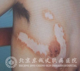 综