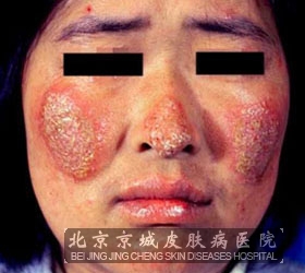 ǴԻ