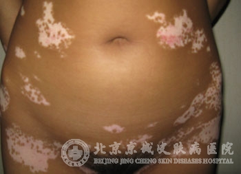 综ܳ
