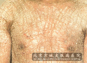 ۲