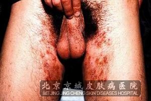 ΪȾѢ