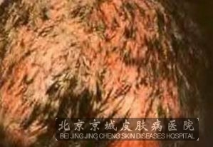 һùͷѢ