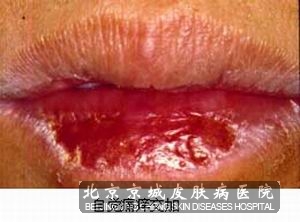  촽ڲ