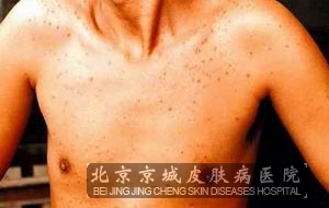 ʮĿӾë׼ʷô