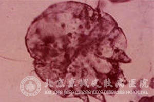괯δ