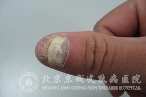 ������ָ�׵�����