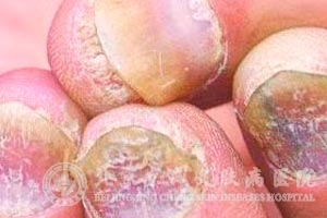 ��ָ�׵�������ʲô