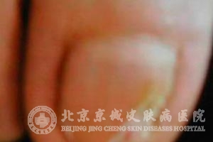 ��ָ����ô���ƺ�