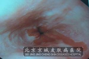 ˽ٴϵҳ没