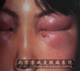 ǴθЩ