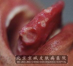 ǻô