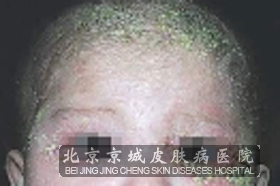 Ӥʪ֢״ͼƬ