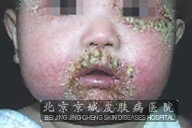 Ӥʪʲô֢״
