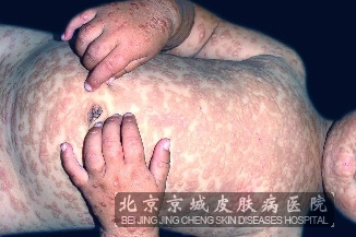 ݡƤͼƬ