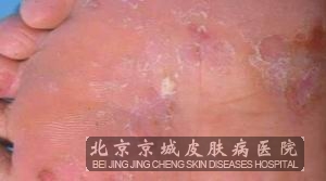 ѢЩ޴Σ