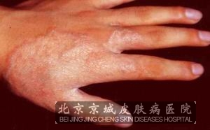 ƷƤα