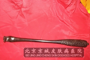 全身皮肤瘙痒的原因是什么