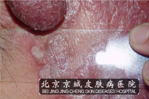 ŧ崯