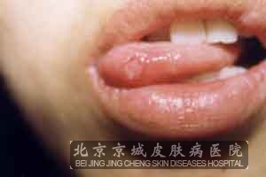 ˿ǻô
