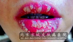 Һٷʺ״ô