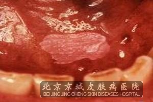 ҪԿǻճĤװ߼Ƥ