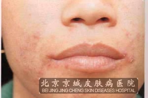 ����ٴ���������Щ