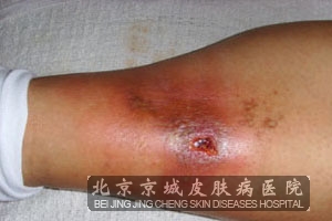 ��Щ���׵õ���