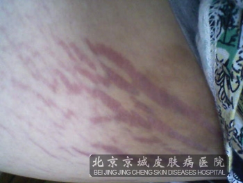 人口红利萎缩困扰香港_挥潇洒彩笔 图风雪人物 李志清绘画金庸