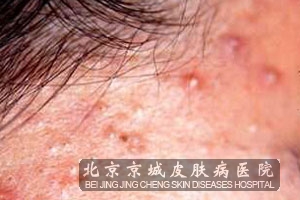 �����Ҫ��ô��