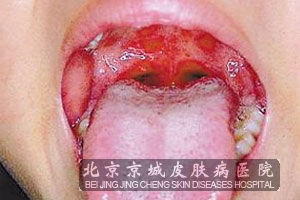 ôԤڲ