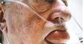 Ѫˮٴ֢״Щ