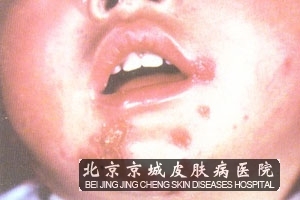 ŧ崯ô