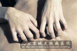 得了皮肤瘙痒症怎么处理
