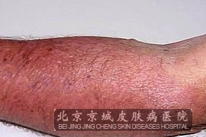 ʲô�����׵õ���