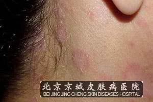 ����Ƥ����ô����