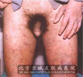 ȾϽ괯ô