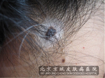 综ҪٳԲ