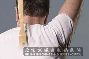 引起皮肤瘙痒症的疾病有哪些