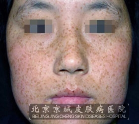Ϊʲôȸ߻沿