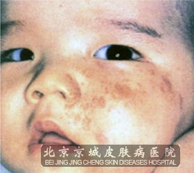 沿Ȱ