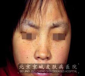 Ů沿ȸߵ֢״