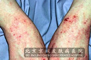 ʪԭЩ