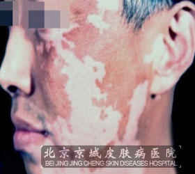 沿综νл