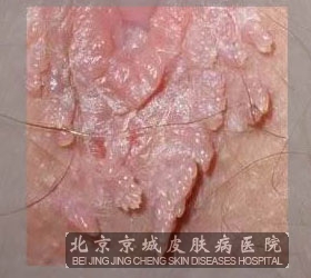 ǱڵļʪЩ֢״