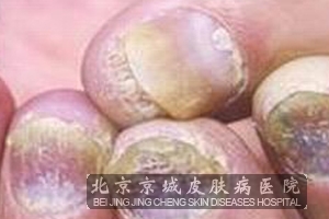 Ѣô