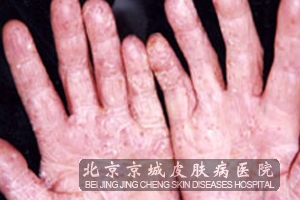 ���Ʒ���Ҫ����Щ��������