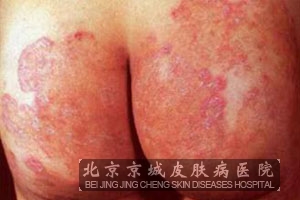 Ѣļ鷽Щ