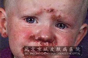 ŧ崯ʲô֢״