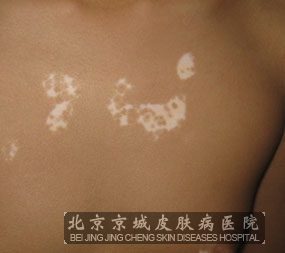 综ε